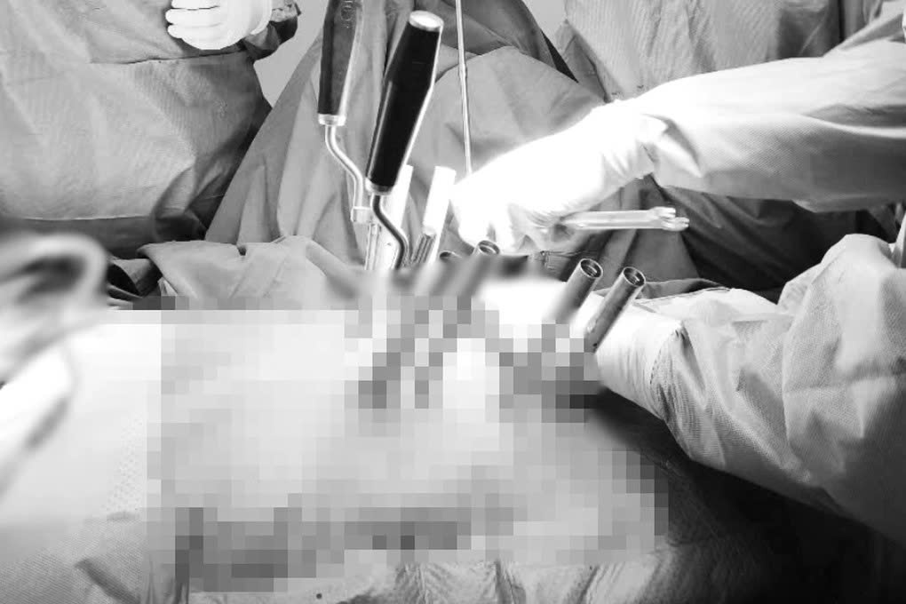 Thang máy đứt cáp, người phụ nữ chấn thương nặng